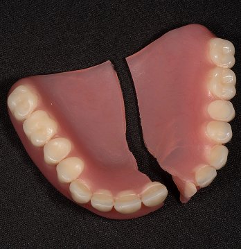 A broken removable denture